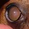 Cataract door hypocalcemie