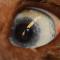 Heterochromia iridis